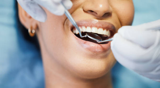 Best Urgent Care for Lost Fillings or Crowns in Marion, KY