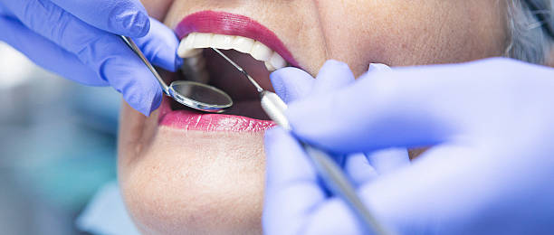 Best Emergency Wisdom Teeth Removal in Marion, KY
